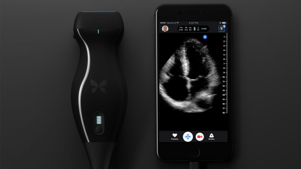 iPhone ile çalışan ultrason cihazı