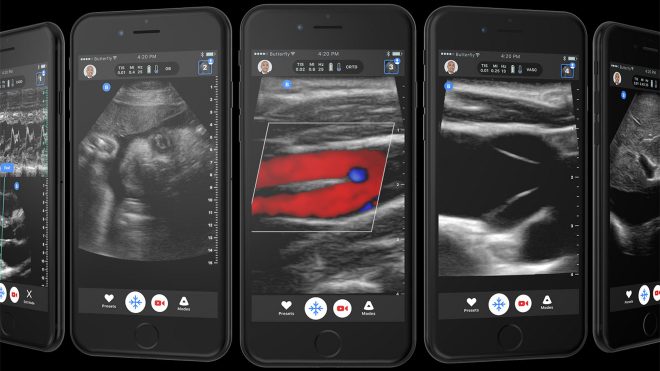 iPhone ile çalışan ultrason cihazı