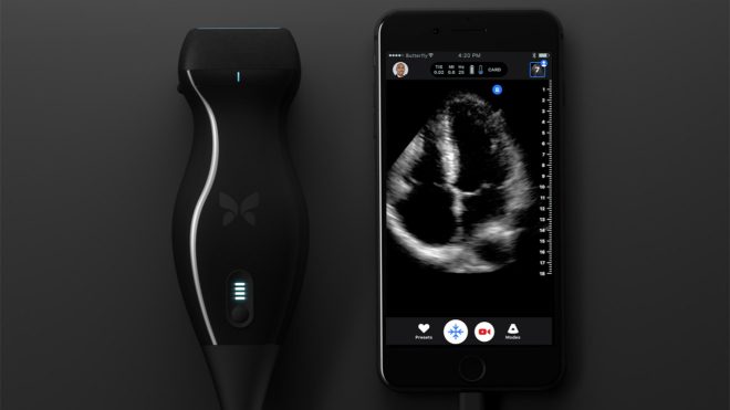 iPhone ile çalışan ultrason cihazı