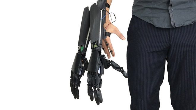 Youbionic