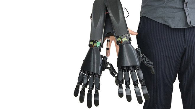 Youbionic