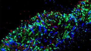 renk körlüğü, laboratuvar, laboratuvar çalışması