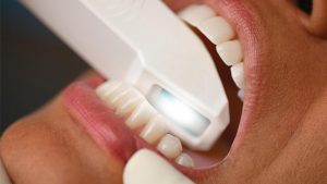 Ağız ve diş sağlığı