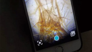 Akıllı telefonları mikroskop haline getiren ürün: DIPLE [Video]