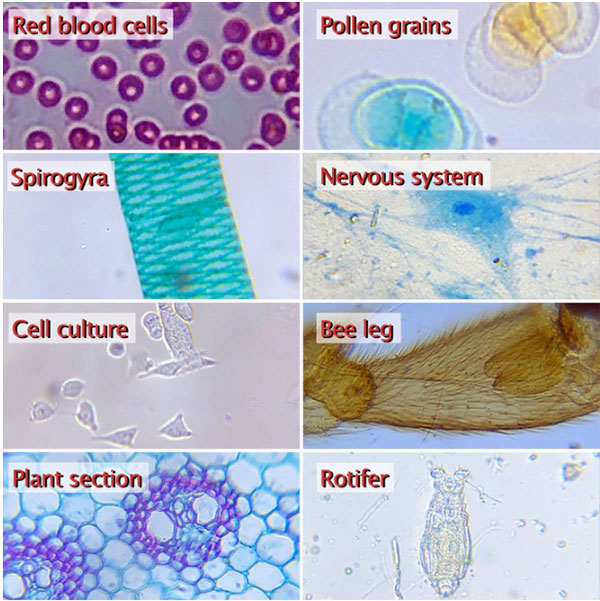 Akıllı telefonları mikroskop haline getiren ürün: DIPLE [Video]