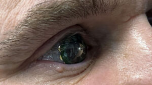Akıllı kontakt lens Mojo Vision